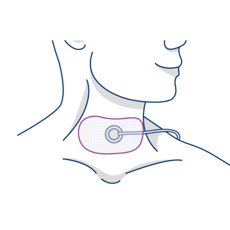 MED504 - Bandes adhésives